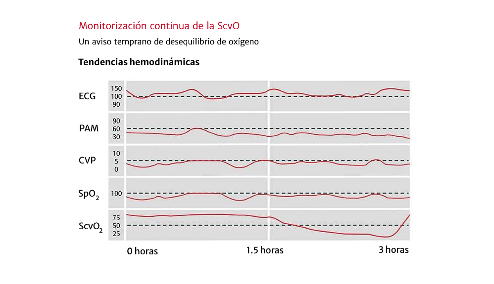 La medición continua de la ScvO2 se puede usar para la monitorización confiable del funcionamiento cardiocirculatorio
